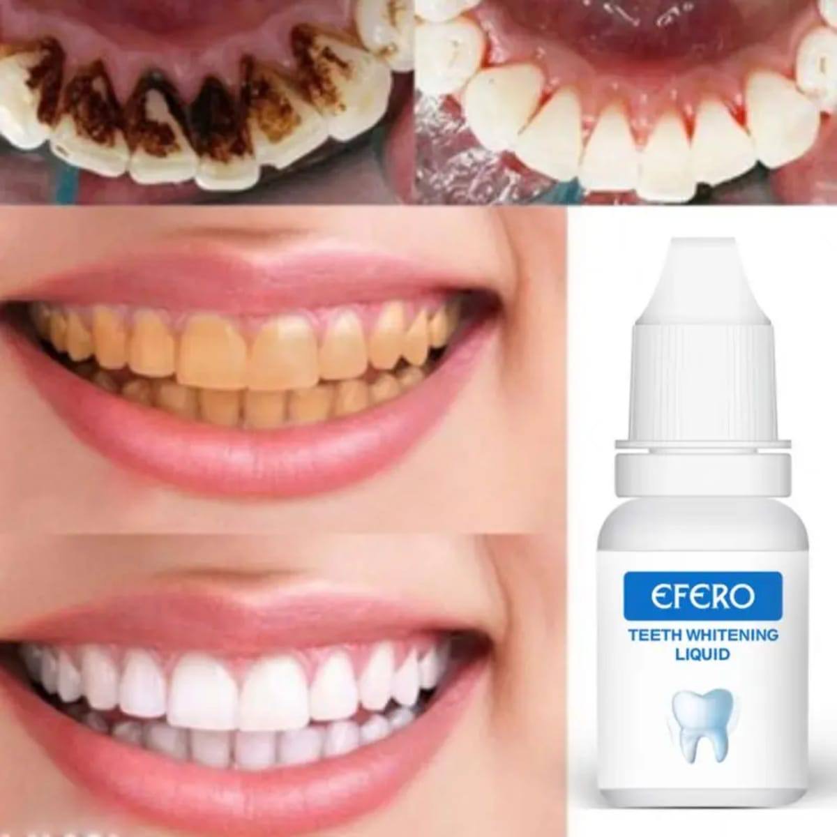 BLANCHISSEUR EFERO DENTS