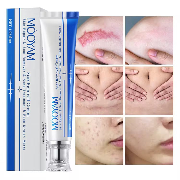 Crème Anti-Acné , Tache , Cicatrice et Vergetures et Mamies
