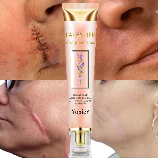 ANTI- CICATRICE & VERGETURES