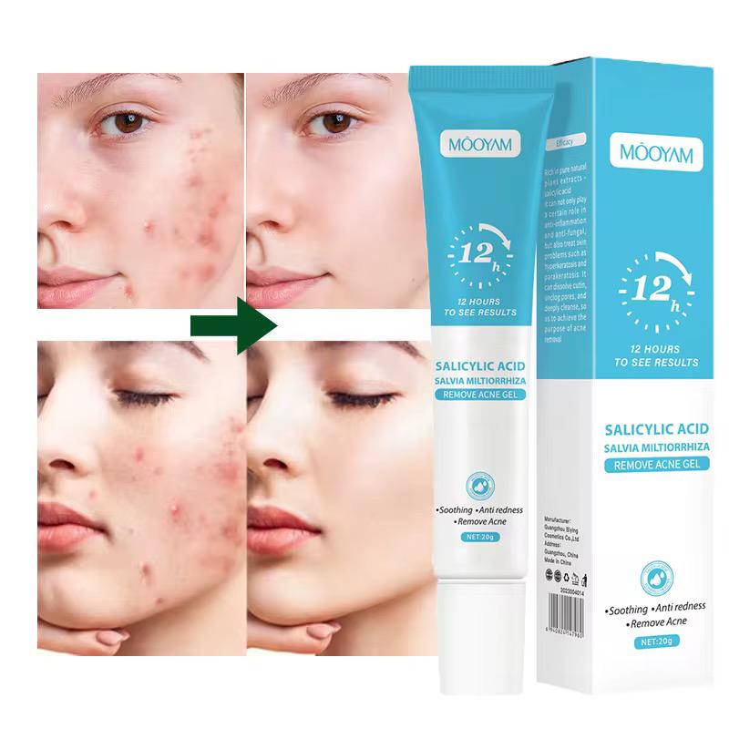 GEL ANTI-ACNÉE 12H