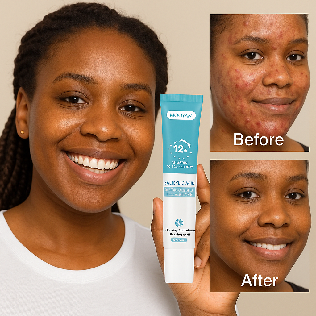 GEL ANTI-ACNÉE 12H