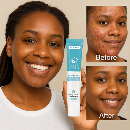 GEL ANTI-ACNÉE 12H